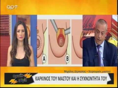 Φροντίδα και Υγεία: Ο Μιχάλης Δέρπαπας μας μιλά για την ογκοπλαστική χειρουργική